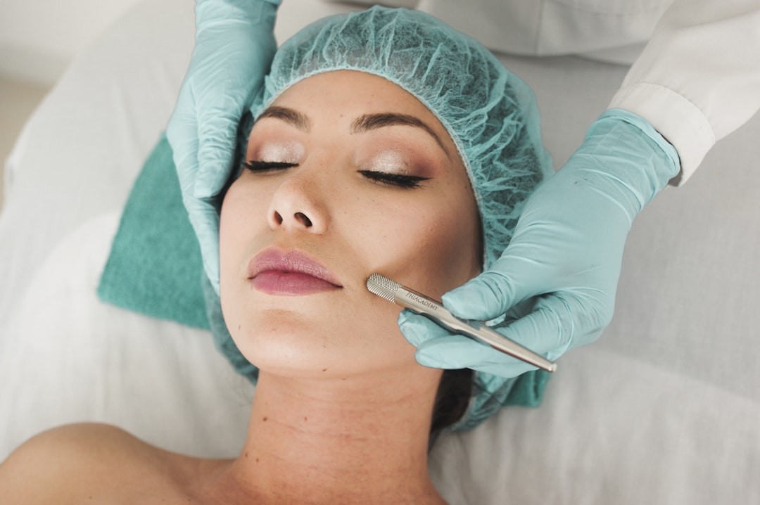 Microneedling (can be combined with PRP)